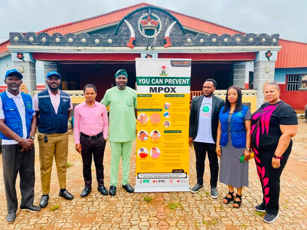 EDSPHCDA, Health Partners Visit Iyase Palace Over MPOX Outbreak in Ovia South West mpox team